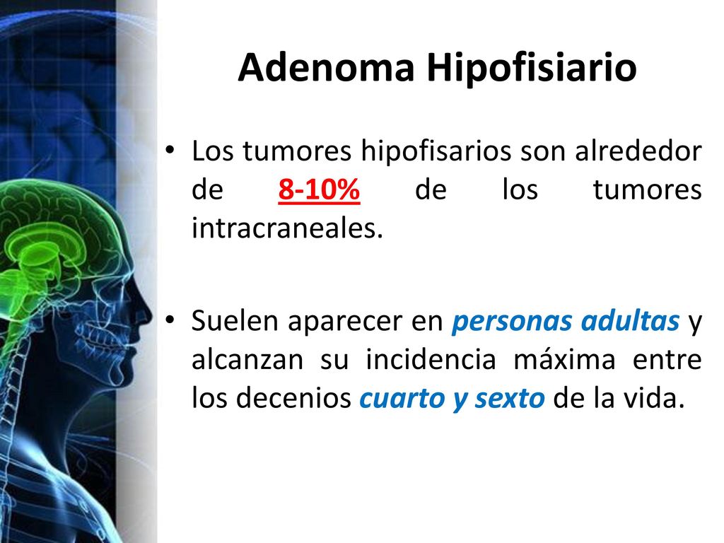 Adenoma Hipofisiario Los tumores hipofisarios son alrededor de 8-10% de los tumores intracraneales.