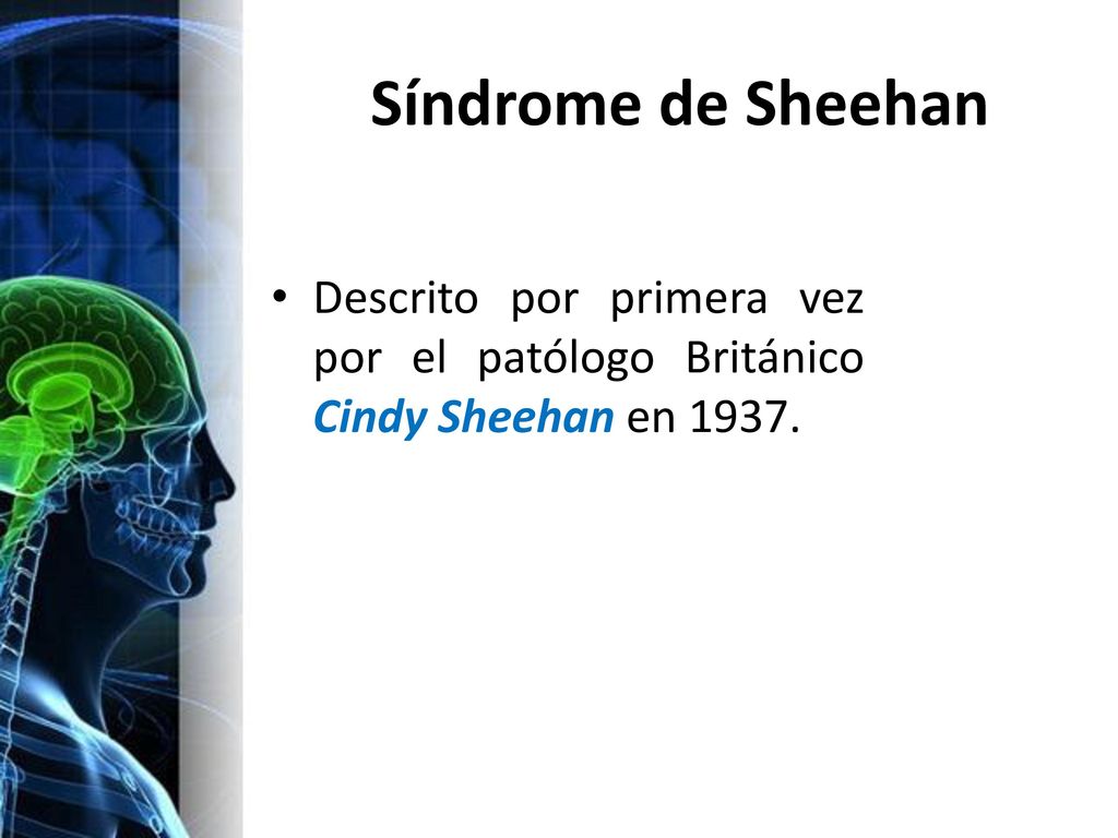 Síndrome de Sheehan Descrito por primera vez por el patólogo Británico Cindy Sheehan en 1937.