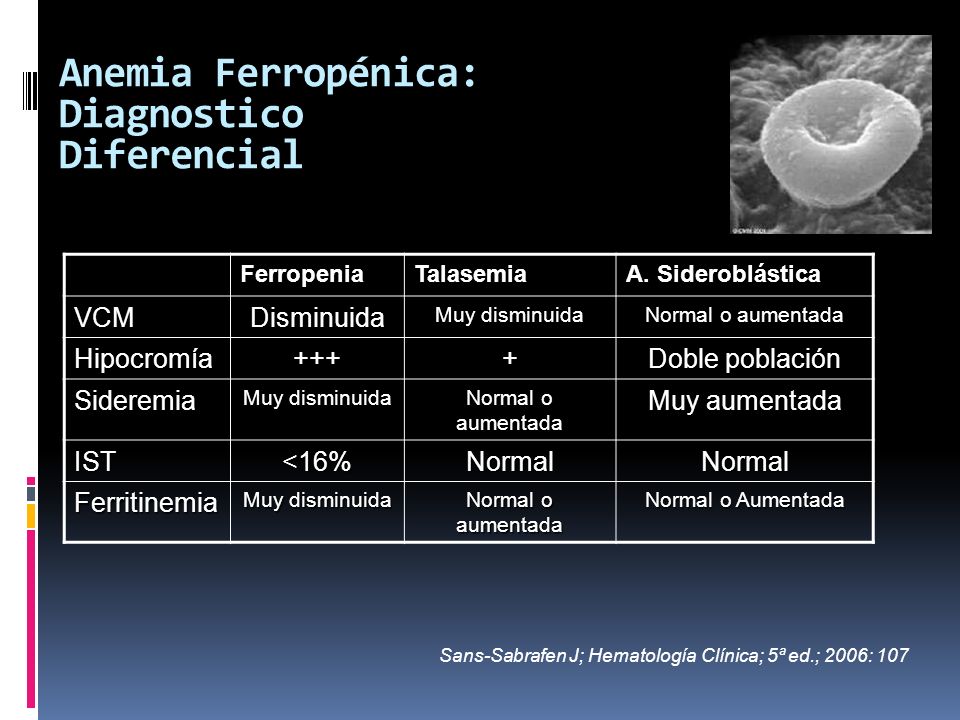 Anemia Ferropénica: Diagnostico Diferencial
