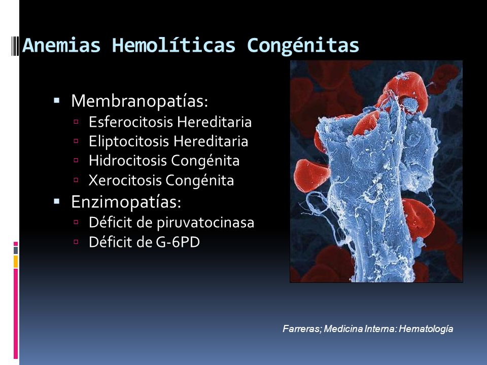 Anemias Hemolíticas Congénitas
