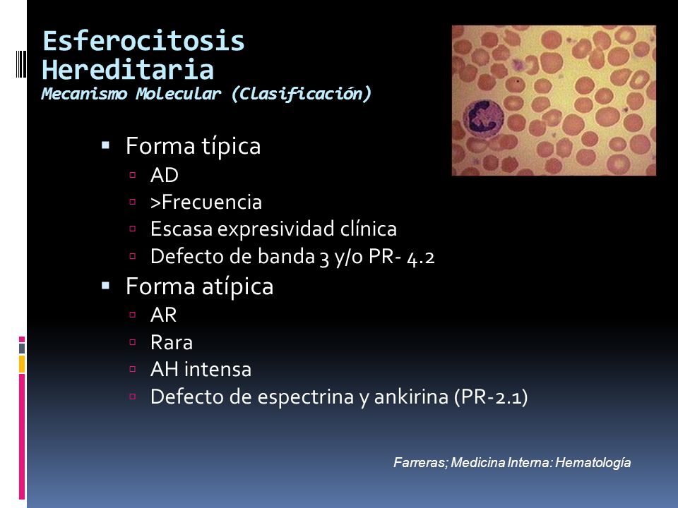 Esferocitosis Hereditaria Mecanismo Molecular (Clasificación)