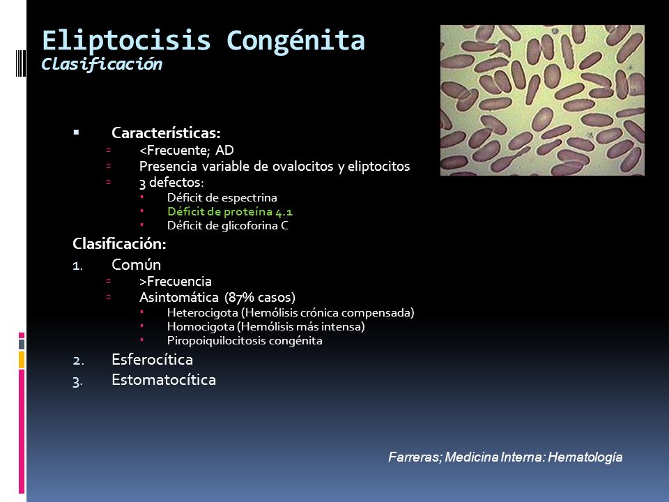 Eliptocisis Congénita Clasificación
