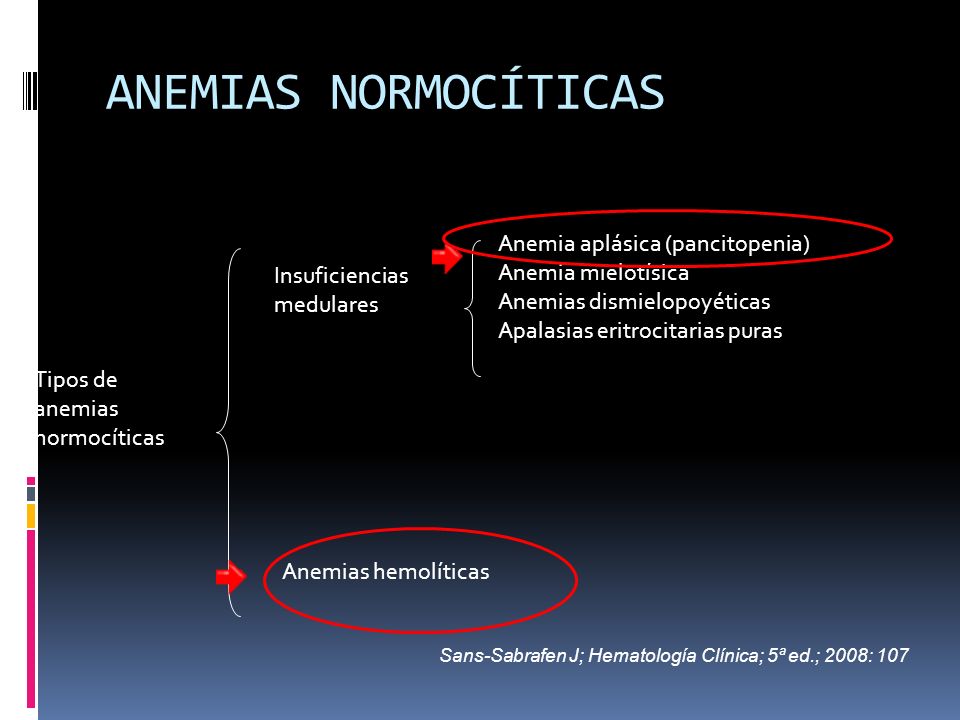 ANEMIAS NORMOCÍTICAS Anemia aplásica (pancitopenia) Anemia mielotísica