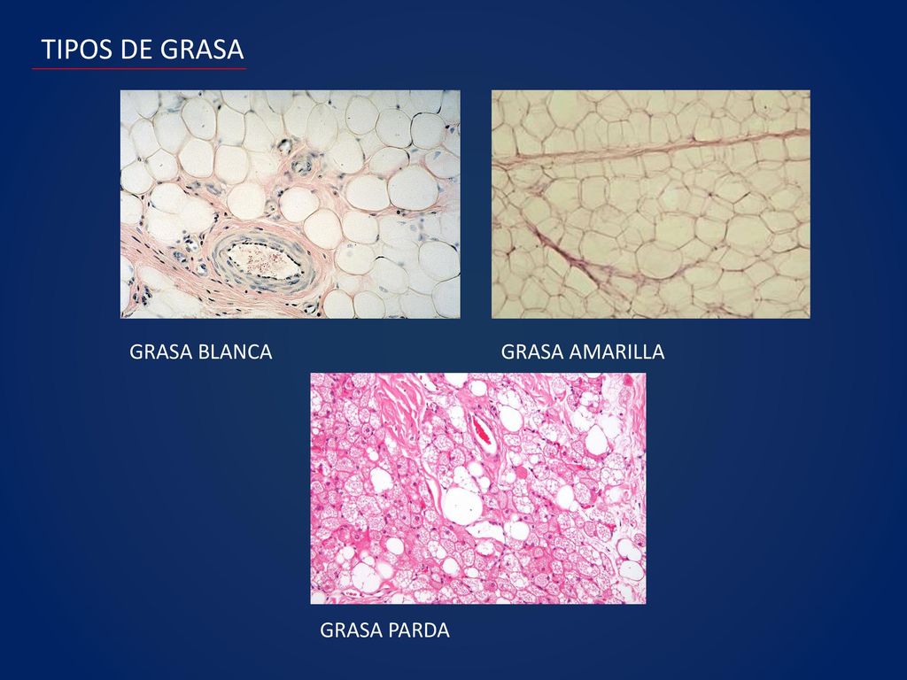 TIPOS DE GRASA GRASA BLANCA GRASA AMARILLA GRASA PARDA