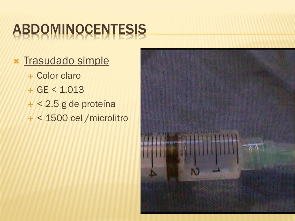 Abdominocentesis Trasudado simple Color claro GE < 1.013