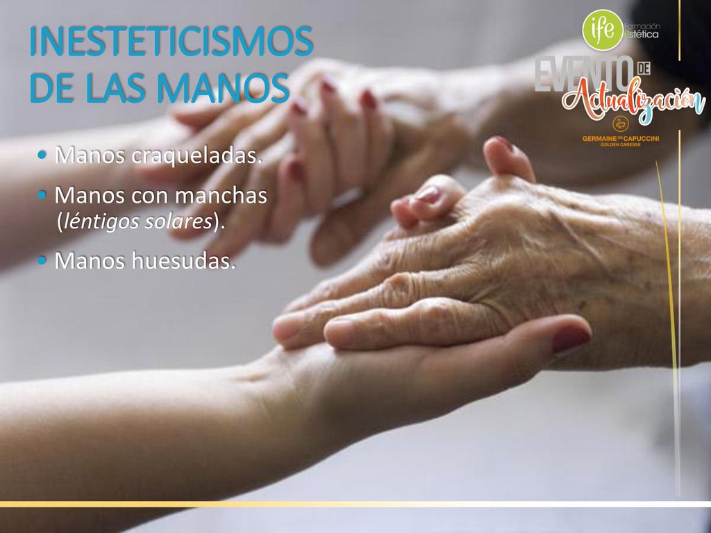 INESTETICISMOS DE LAS MANOS • Manos craqueladas. • Manos con manchas