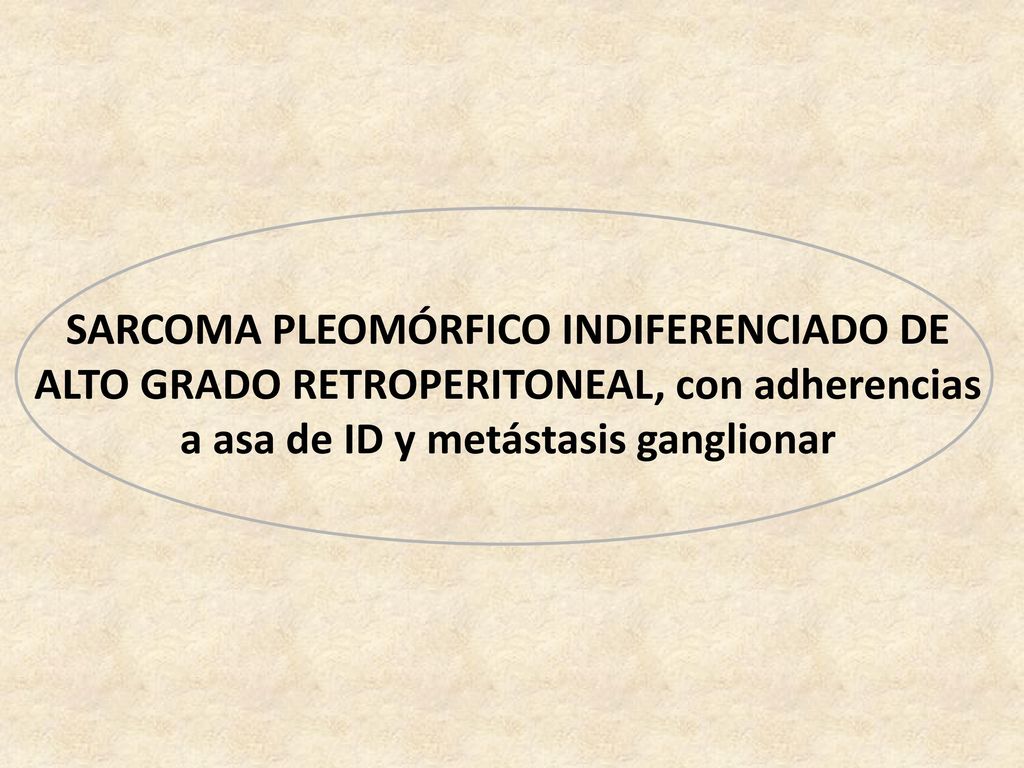 SARCOMA PLEOMÓRFICO INDIFERENCIADO DE ALTO GRADO RETROPERITONEAL, con adherencias a asa de ID y metástasis ganglionar