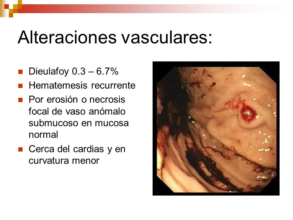 Alteraciones vasculares: