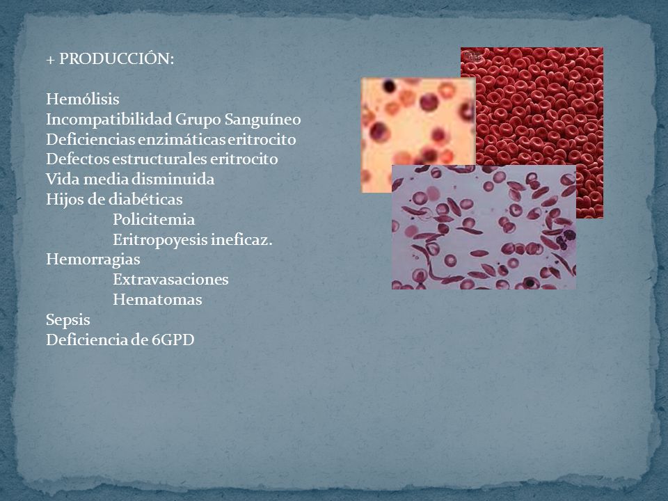 + PRODUCCIÓN: Hemólisis. Incompatibilidad Grupo Sanguíneo. Deficiencias enzimáticas eritrocito. Defectos estructurales eritrocito.