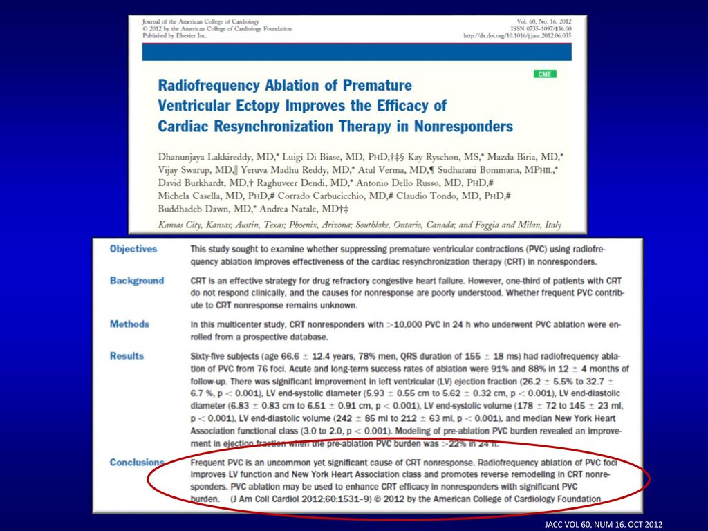And one of the reasons for pacing less than 100% is the presence of frequent PVCs……