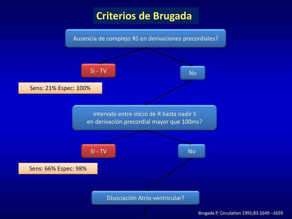 Criterios de Brugada Ausencia de complejo RS en derivaciones precordiales Si - TV. No. Sens: 21% Espec: 100%