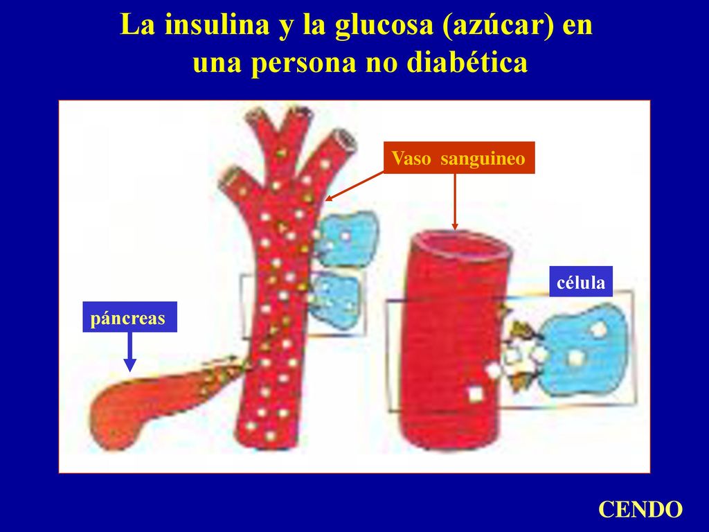La insulina y la glucosa (azúcar) en una persona no diabética