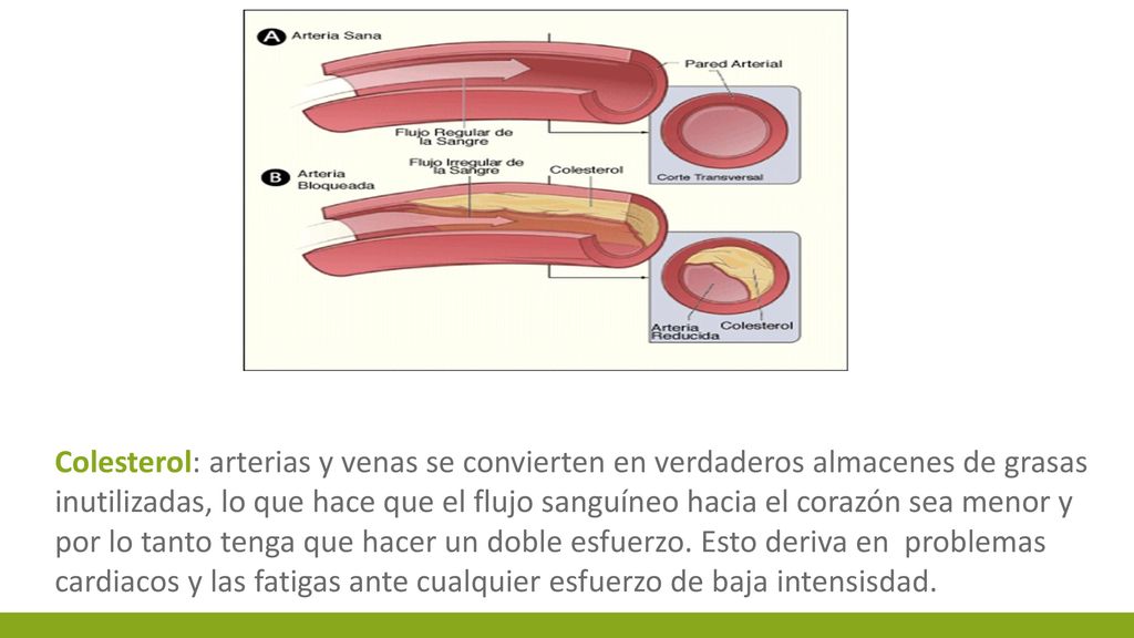 Colesterol: arterias y venas se convierten en verdaderos almacenes de grasas inutilizadas, lo que hace que el flujo sanguíneo hacia el corazón sea menor y por lo tanto tenga que hacer un doble esfuerzo.