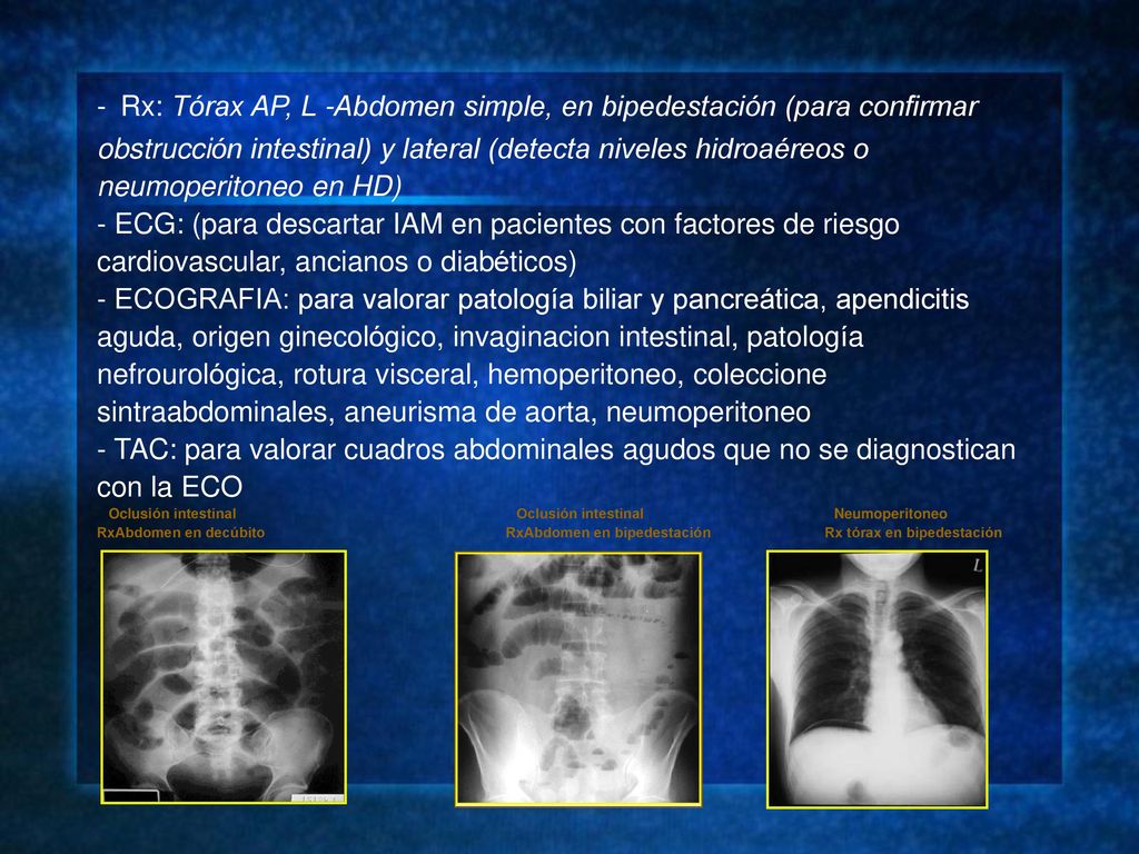 - Rx: Tórax AP, L -Abdomen simple, en bipedestación (para confirmar