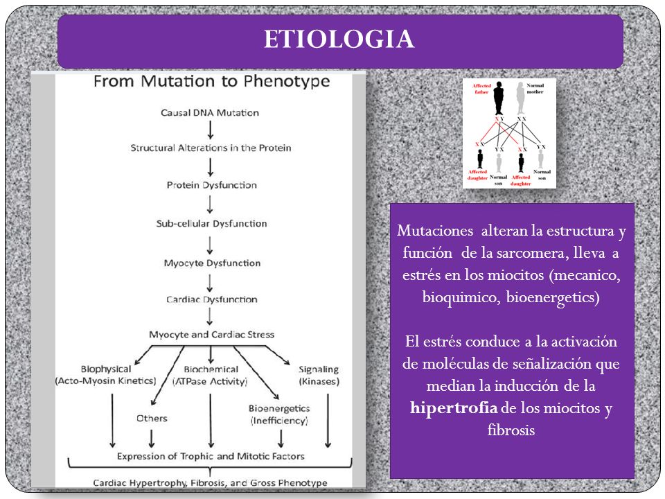 ETIOLOGIA Mutaciones alteran la estructura y función de la sarcomera, lleva a estrés en los miocitos (mecanico, bioquimico, bioenergetics)