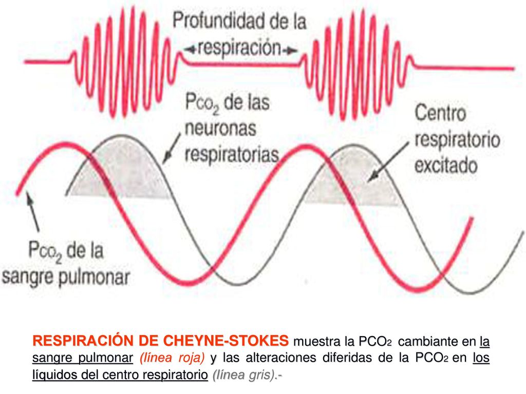 RESPIRACIÓN DE CHEYNE-STOKES muestra la PCO2 cambiante en la sangre pulmonar (línea roja) y las alteraciones diferidas de la PCO2 en los líquidos del centro respiratorio (línea gris).-