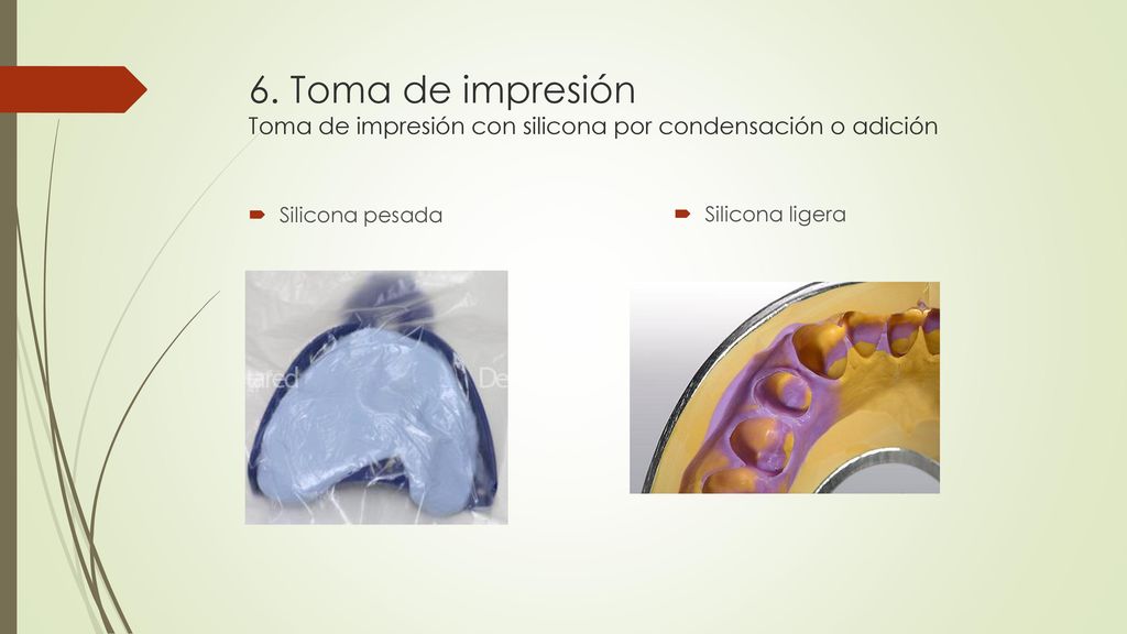 6. Toma de impresión Toma de impresión con silicona por condensación o adición