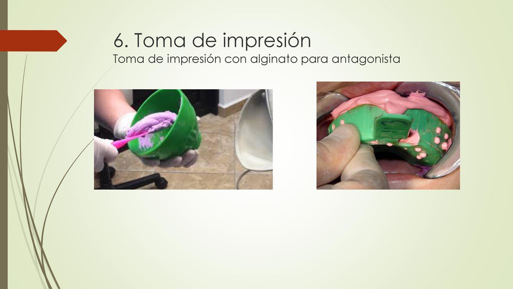 6. Toma de impresión Toma de impresión con alginato para antagonista