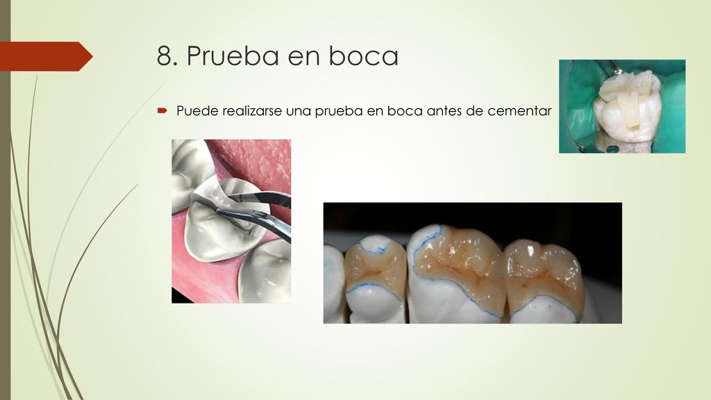 8. Prueba en boca Puede realizarse una prueba en boca antes de cementar