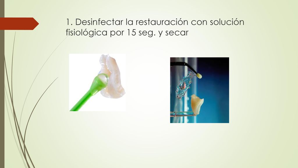 1. Desinfectar la restauración con solución fisiológica por 15 seg