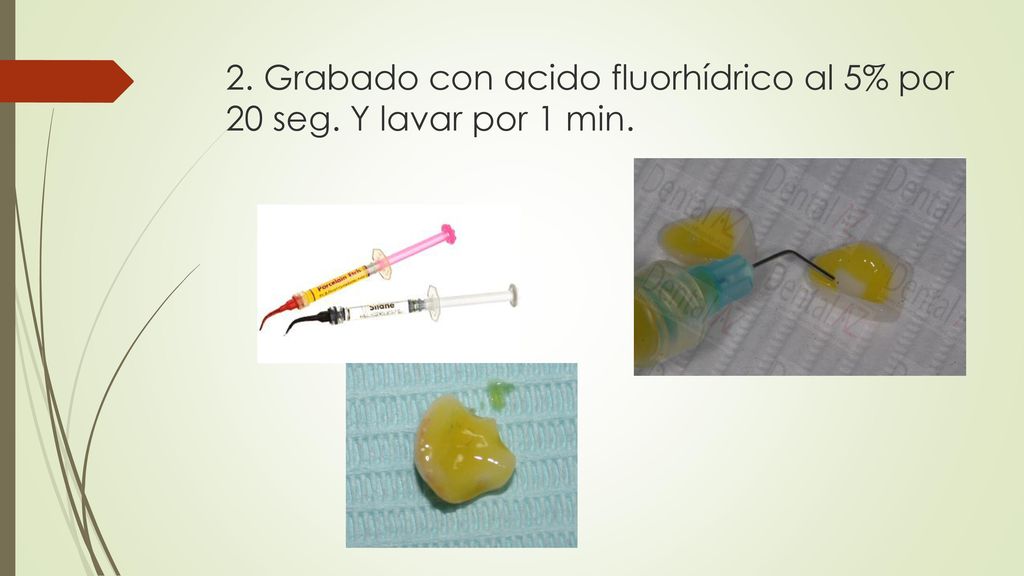 2. Grabado con acido fluorhídrico al 5% por 20 seg. Y lavar por 1 min.