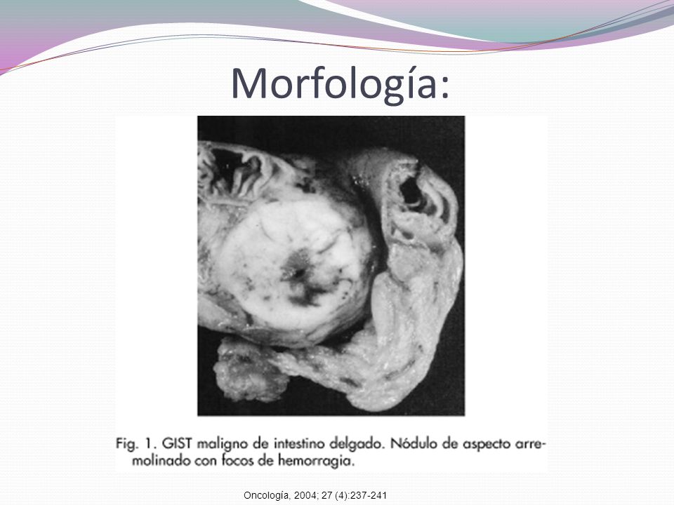 Morfología: Oncología, 2004; 27 (4):