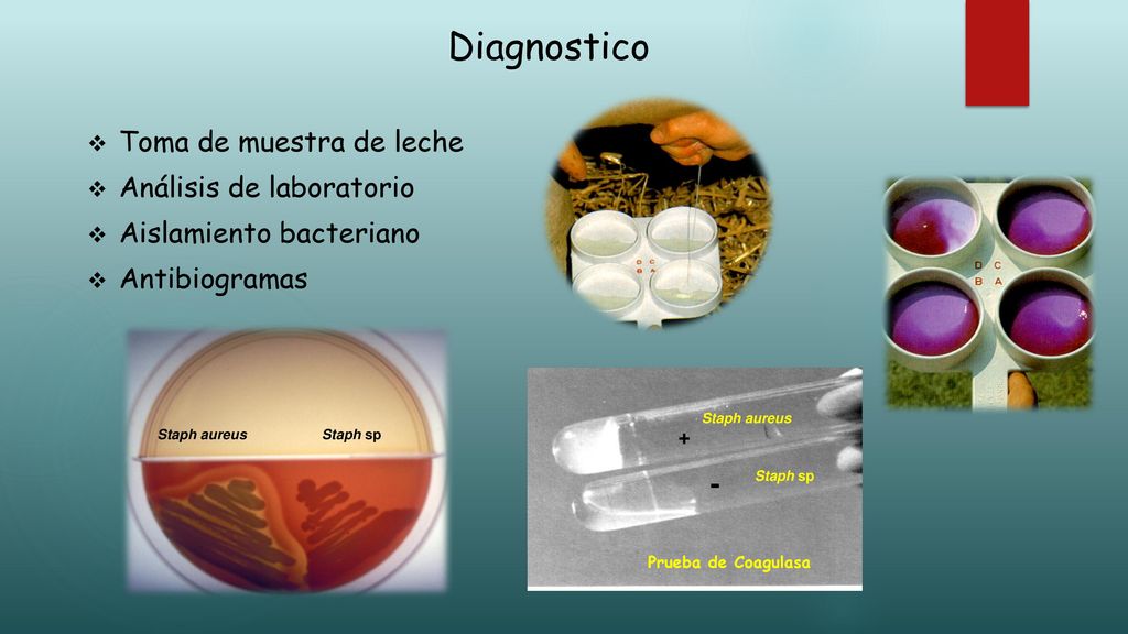 Diagnostico - Toma de muestra de leche Análisis de laboratorio