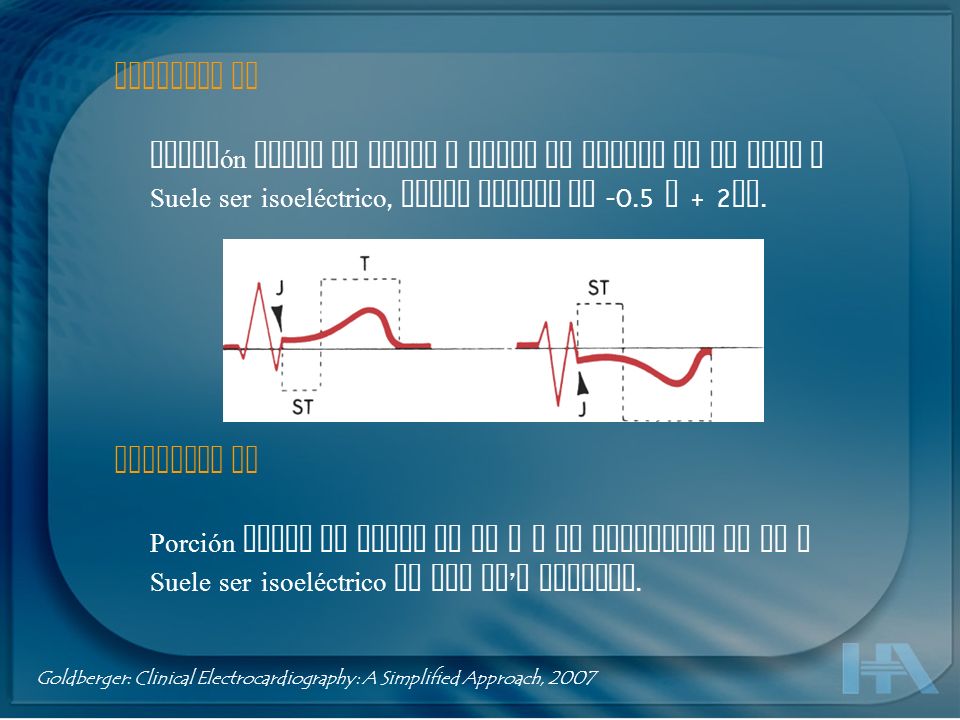 Porción entre el punto J hasta el inicio de la onda T