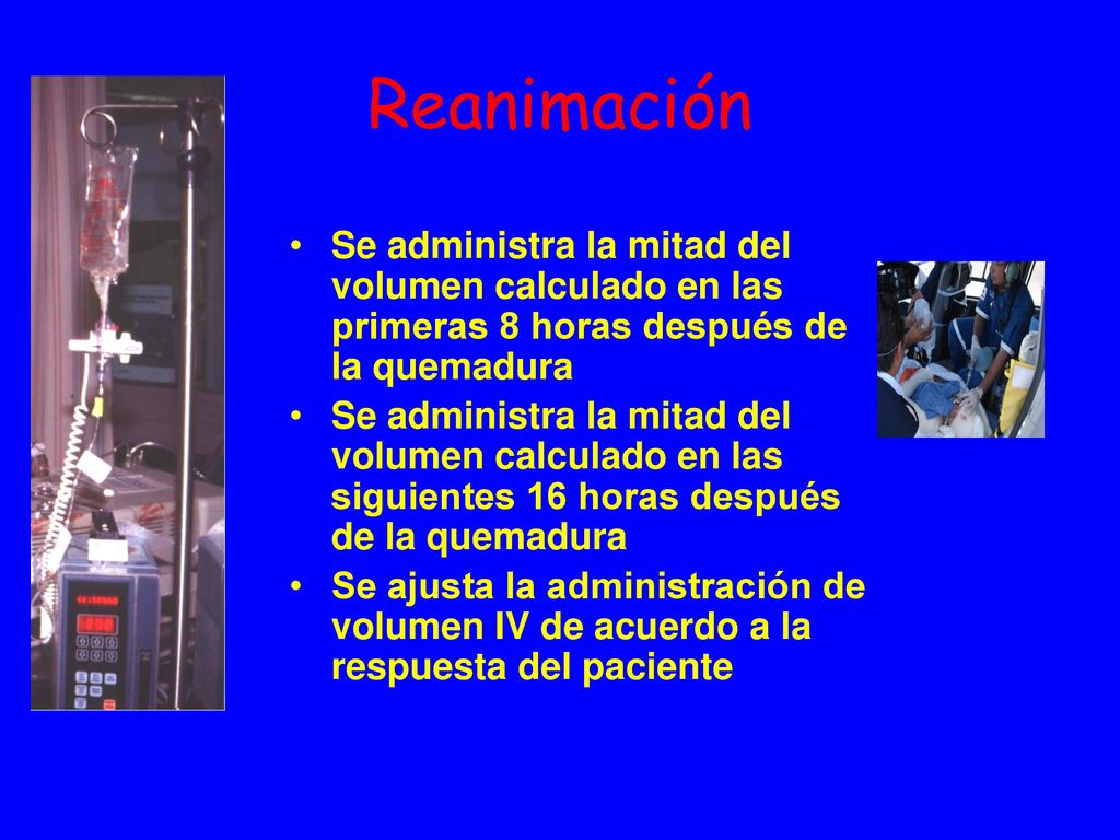 Reanimación Se administra la mitad del volumen calculado en las primeras 8 horas después de la quemadura.