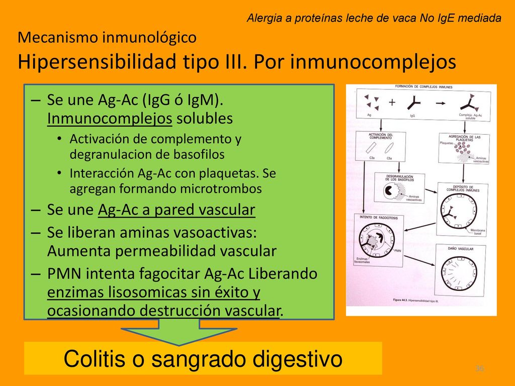 Mecanismo inmunológico Hipersensibilidad tipo III. Por inmunocomplejos