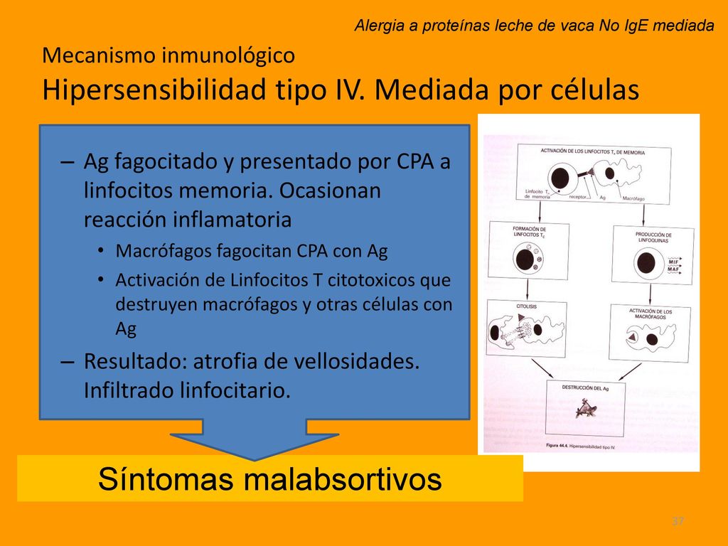 Mecanismo inmunológico Hipersensibilidad tipo IV. Mediada por células