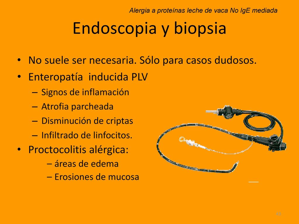 Endoscopia y biopsia No suele ser necesaria. Sólo para casos dudosos.