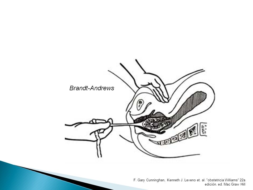Brandt-Andrews F. Gary Cunninghan, Kenneth J. Leveno et.