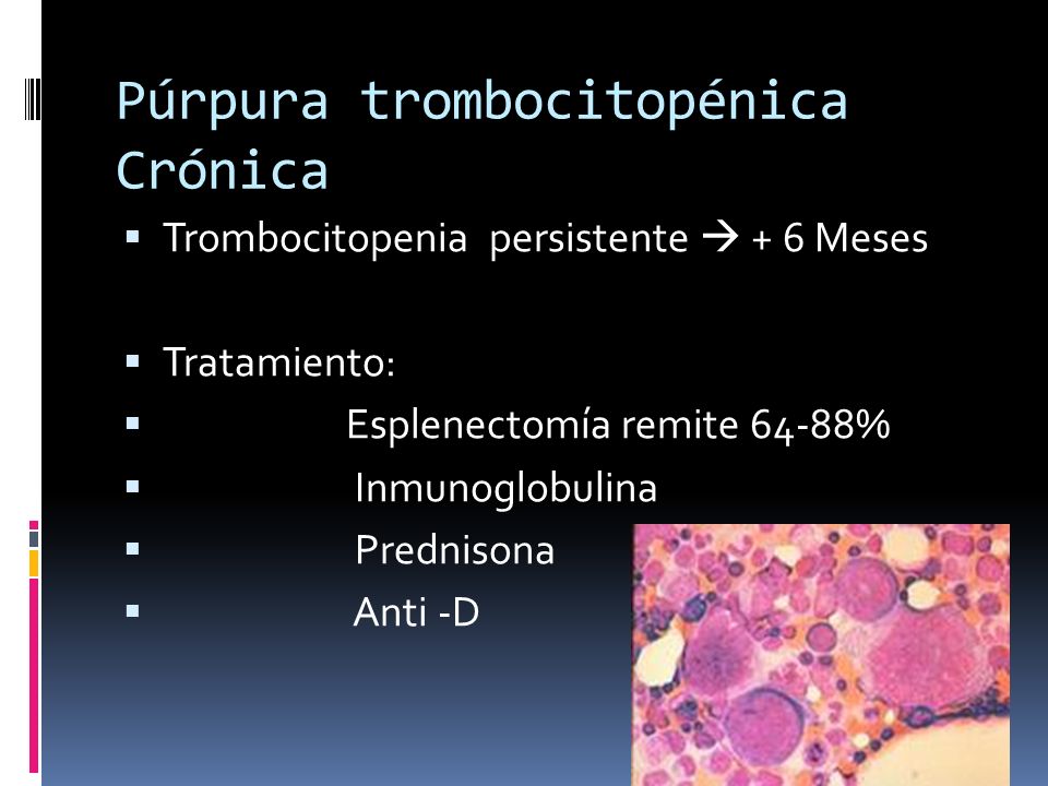 Púrpura trombocitopénica Crónica