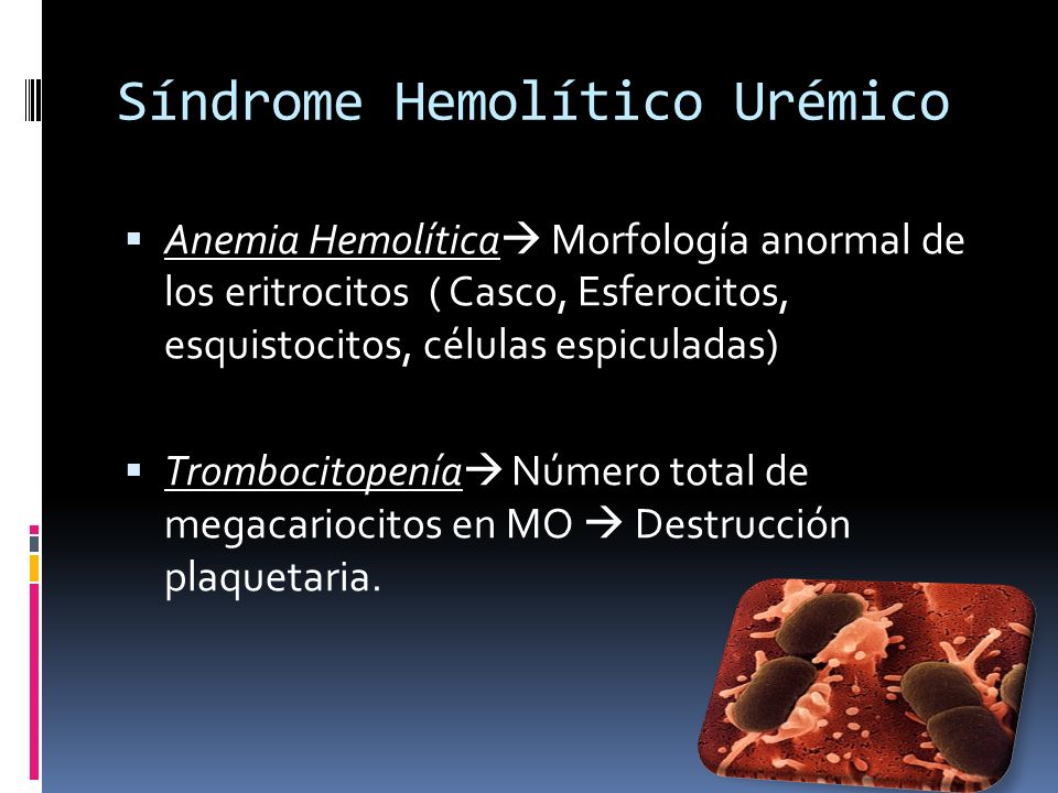 Síndrome Hemolítico Urémico