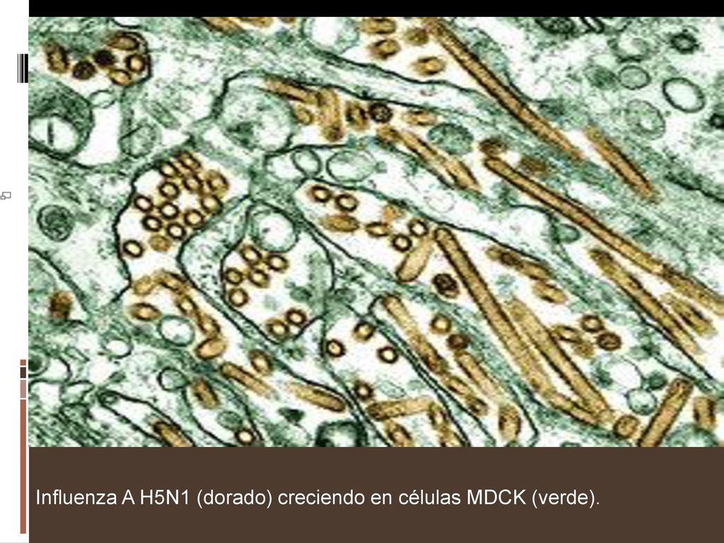 Influenza A H5N1 (dorado) creciendo en células MDCK (verde).