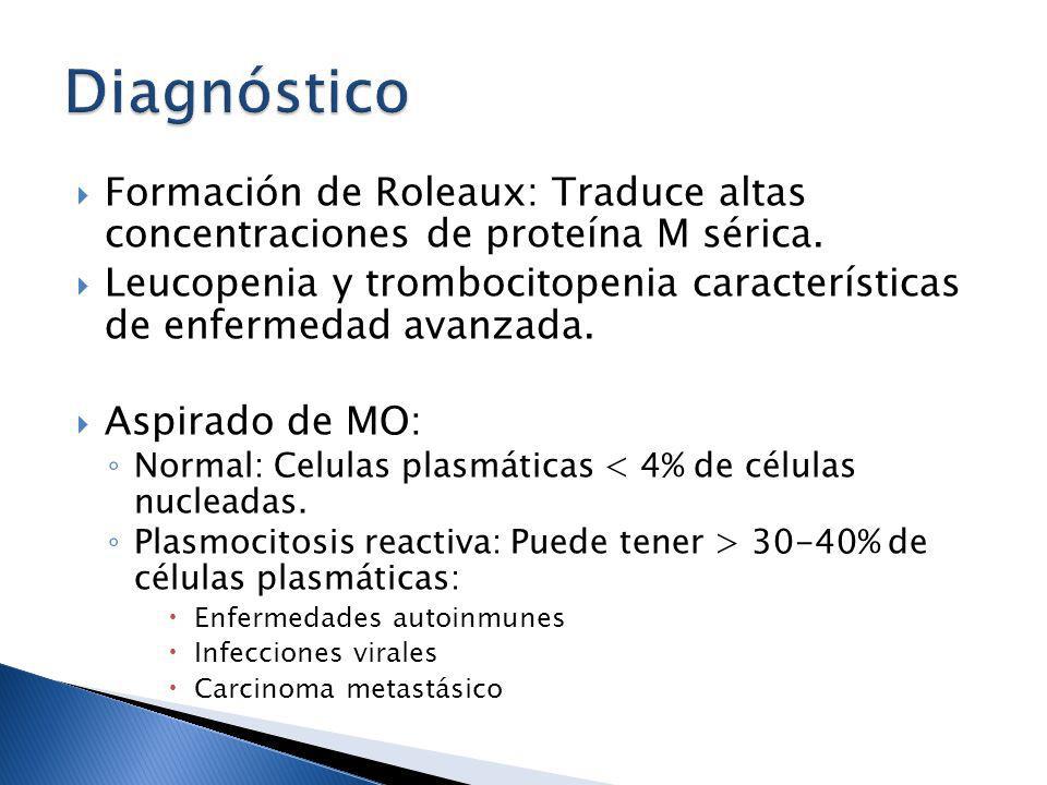 Diagnóstico Formación de Roleaux: Traduce altas concentraciones de proteína M sérica.