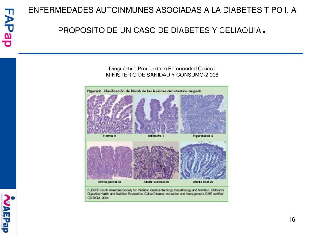 ENFERMEDADES AUTOINMUNES ASOCIADAS A LA DIABETES TIPO I