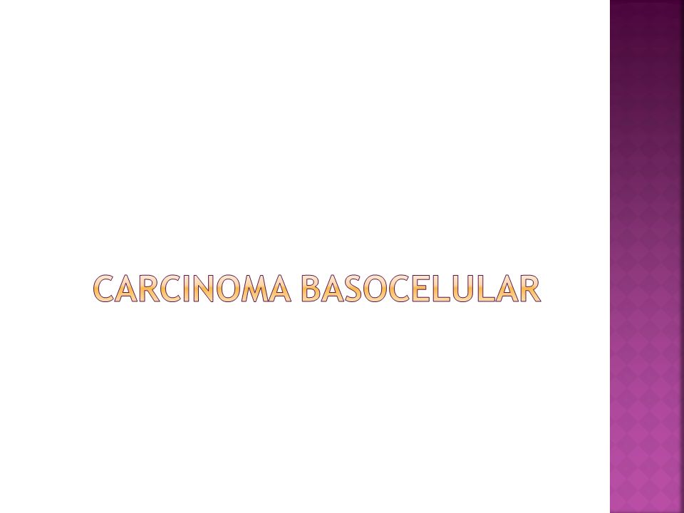 CArcinoma BASOCELULAR
