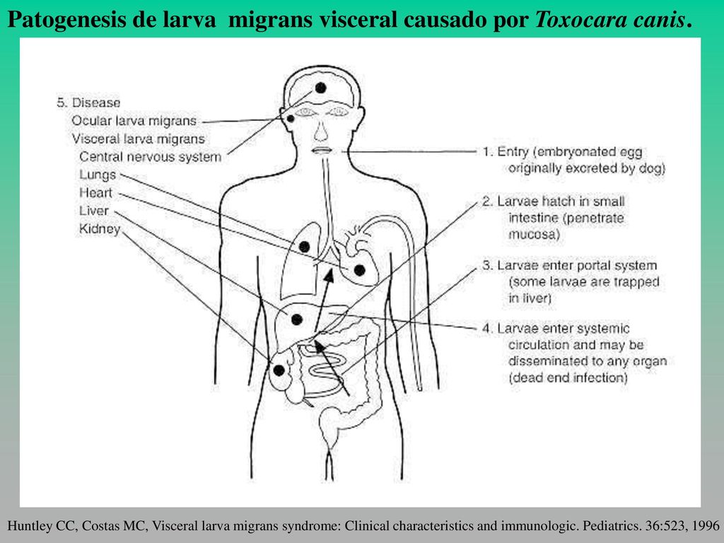 Patogenesis de larva migrans visceral causado por Toxocara canis.