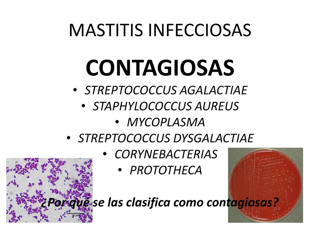 ¿Por qué se las clasifica como contagiosas