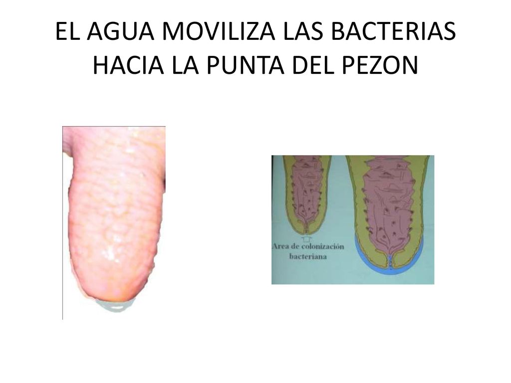 EL AGUA MOVILIZA LAS BACTERIAS HACIA LA PUNTA DEL PEZON