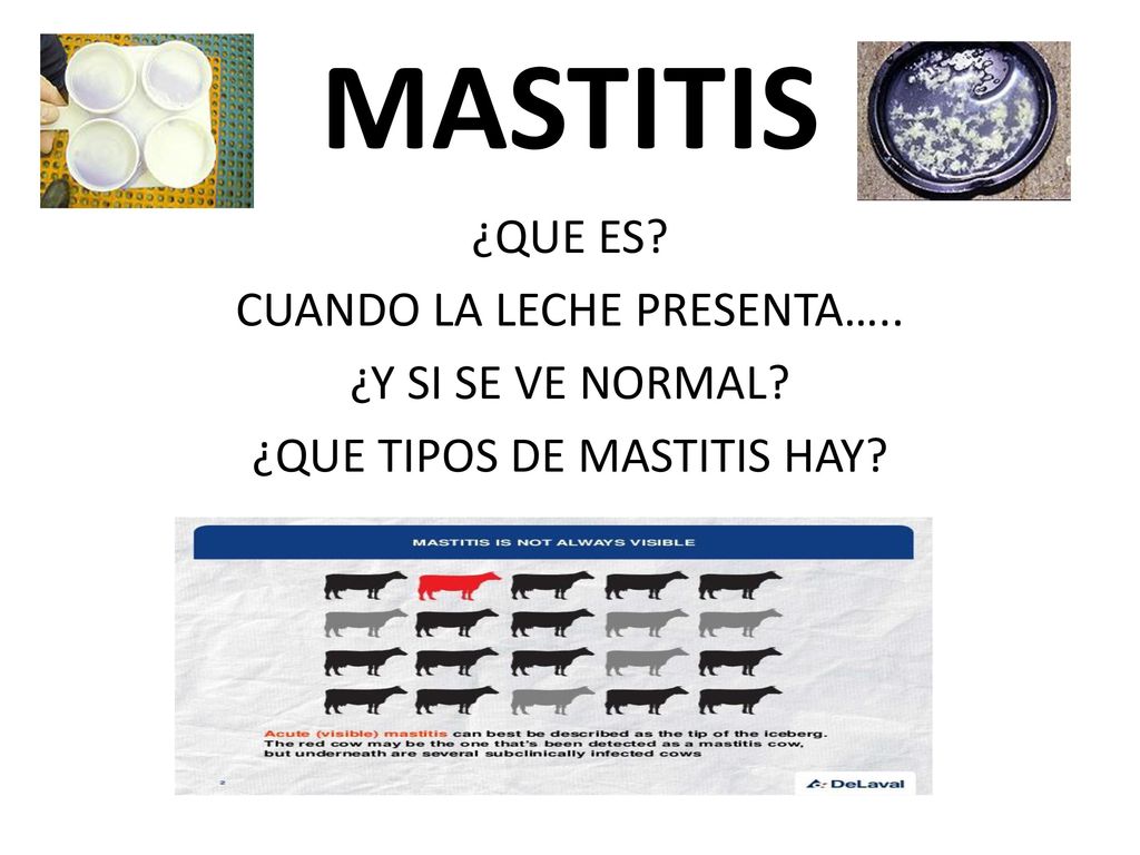 MASTITIS ¿QUE ES CUANDO LA LECHE PRESENTA….. ¿Y SI SE VE NORMAL ¿QUE TIPOS DE MASTITIS HAY