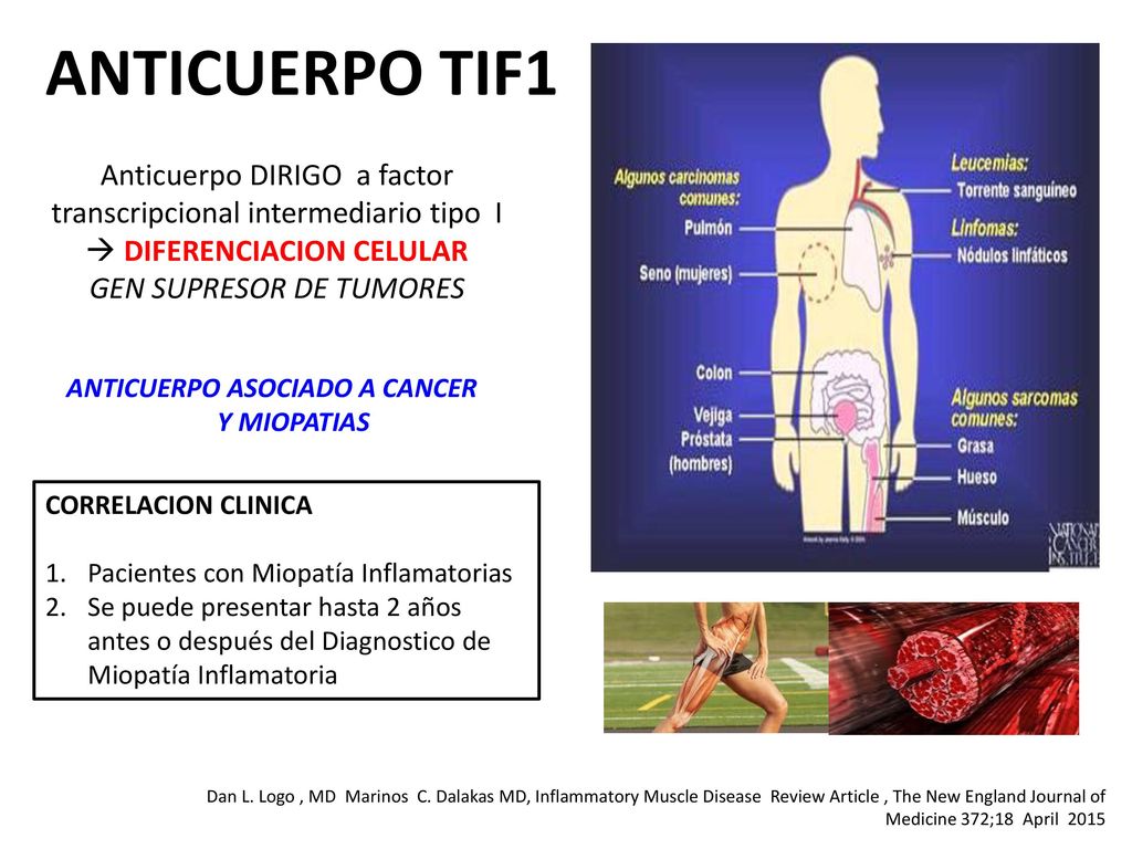 ANTICUERPO TIF1 Anticuerpo DIRIGO a factor transcripcional intermediario tipo I  DIFERENCIACION CELULAR GEN SUPRESOR DE TUMORES.