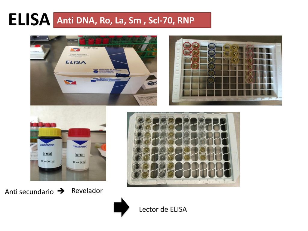 ELISA Anti DNA, Ro, La, Sm , Scl-70, RNP Anti secundario  Revelador
