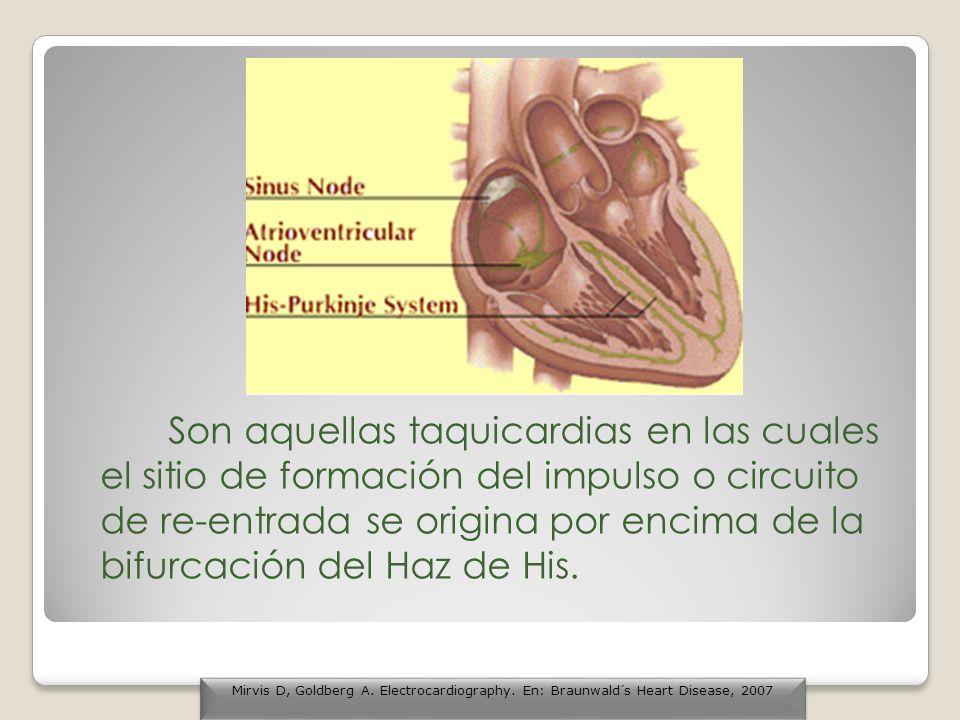 Son aquellas taquicardias en las cuales el sitio de formación del impulso o circuito de re-entrada se origina por encima de la bifurcación del Haz de His.