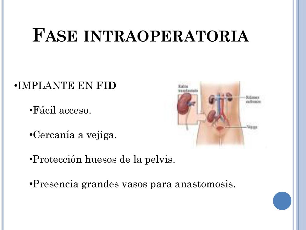 Fase intraoperatoria IMPLANTE EN FID Fácil acceso. Cercanía a vejiga.