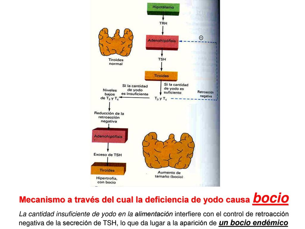Mecanismo a través del cual la deficiencia de yodo causa bocio