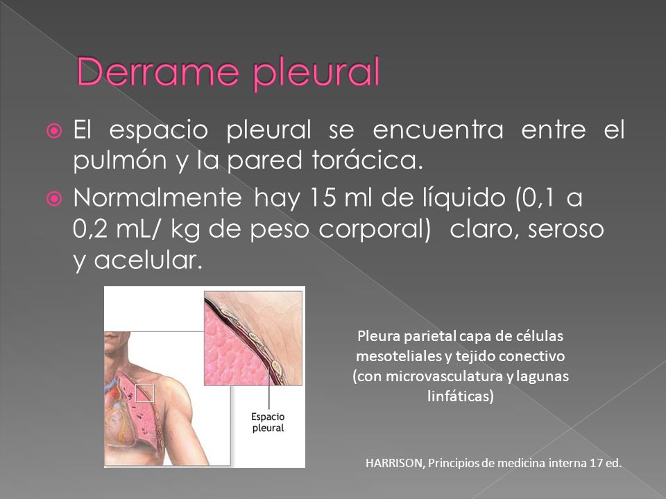 Derrame pleural El espacio pleural se encuentra entre el pulmón y la pared torácica.