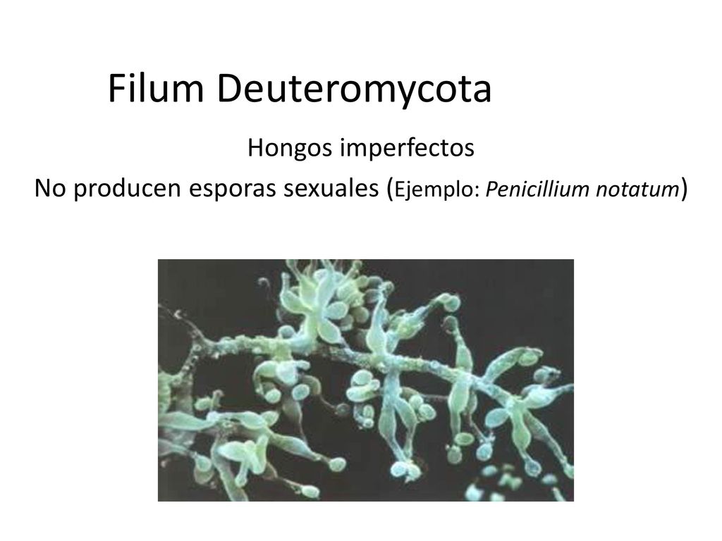 Filum Deuteromycota Hongos imperfectos No producen esporas sexuales (Ejemplo: Penicillium notatum)